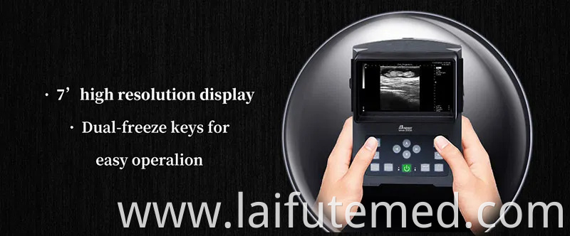 Animal Ultrasound Scanning Machine Bw590V Digital Veterinary Diagnostic Ultrasonic Imaging System, Ideal for Veterinary Service Center, Research Institute